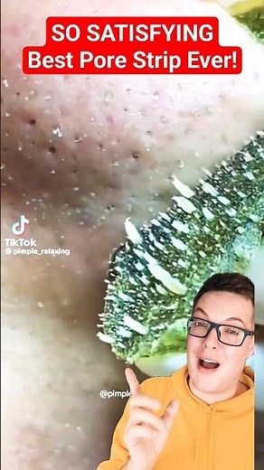 Seriously Amazing PORE STRIP REMOVAL #shorts