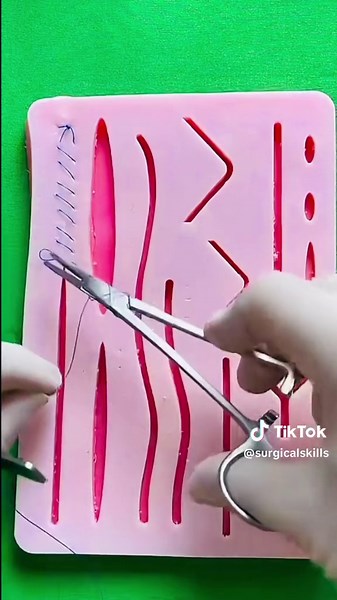 Suturing techniques 🧑‍⚕️#surgicalskills #foryou