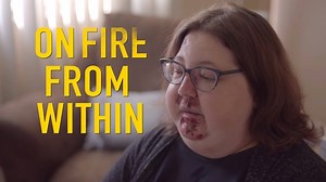 When she was 8 months pregnant, Mallory developed painful, burning skin lesions and chronic pain. Over time, her disease has spread and her life has come to a halting stop. Can you help her find a cure? | Chasing The Cure