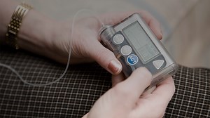 How the Artificial Pancreas Can Help Diabetic Patients