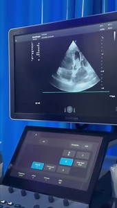 Understant critical care U/S in ICU roud 2 Register in our recorded online course to learn so many critical care U/S tricks which will change your way of management and boost your ICU skills. We are continuously upgrading our courses., so you will expect new lectures to be added to your course from time to time. Attention please, now the complete Lower Limb arterial and venous Doppler course is added to our recorded critical care U/S from basic to advanced course. Also, this week 10 new lectures