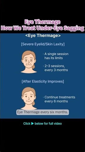 Eye Thermage 🌸 Long-Lasting Under-Eye Lifting — Here’s How to Maintain It!
