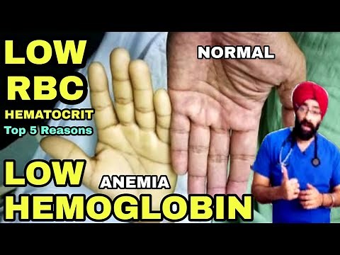 Top 5 Reasons for Low Hemoglobin, ANEMIA, Low RBC count or Hematocrit | Dr.Education (Eng)