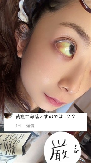 「黄疸って命を○とすのでは…？」「目標は70歳まで生きる！です！#黄疸