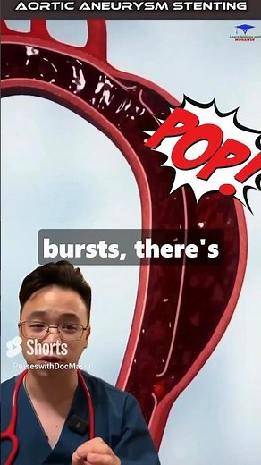 Lethal Conditions Explained - Aortic Dissection Symptoms To Know