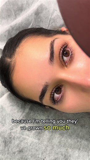Unveiling Lash Botox Reactions