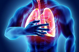 Severe Acute Respiratory Syndrome: What is SARS?