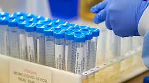 How Long is COVID Contagious and When Can You Leave Isolation?