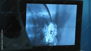 Automated laser machine is cutting the material on a production line. Advanced automated laser machine for steel mechanisms production. Monitor of the automated laser machine shows the cutting process