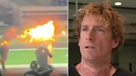 Prankster hospitalised in fiery stunt gone wrong