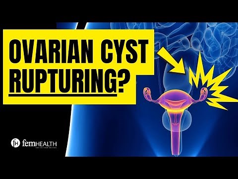 What does an ovarian cyst feel like when it ruptures? What to do for rupturing ovarian cyst?