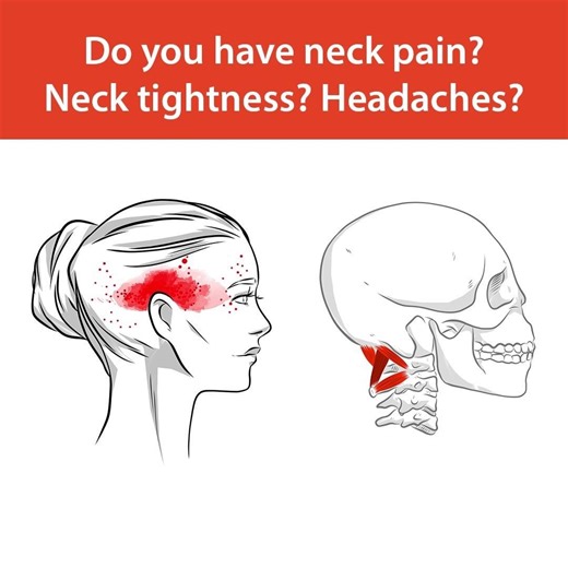 Aletha Health on Instagram: "Headaches and neck tightness? The key could be releasing tension in the hard-to-reach muscles in the base of your skull! The NUCKLE is the only tool designed by a Physical Therapist to target those small muscles at the base of your skull to release, relax, and realign the neck and shoulders. These small muscles at the base of your skull (the suboccipitals) and the pec minor muscles in your chest together create tension resulting in rounded shoulders, hunched back, ne