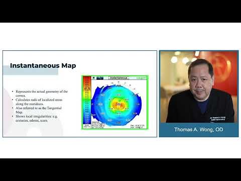 What is Adaptive Optics & Integrated Wavefront Aberrometry? | Thomas Wong, OD Presentation