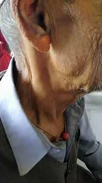 Elevated JVP|Dr Bhupendra Shah |medicine Classroom