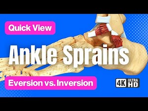 Eversion Ankle Sprain & Inversion Ankle Sprain // See the Comparison // 3D Animation