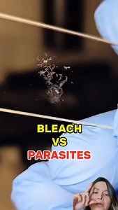 8.2K views · 1.9K reactions | THE DETOX I USED TO PASS LIVER FLUKES:...