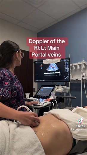 How to Doppler the Rt Lt and main portal veins. Helatopetal flow. Acts as an artery due to volume of blood. Red in color on color map #ultrasound #education #healthcare #Sonography #careertipstiktokcontest