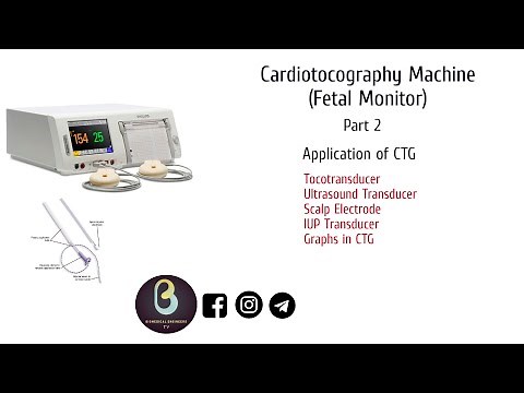 Cardiotocography | Application | Biomedical Engineers TV |