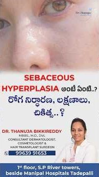 Sebaceous hyperplasia అంటే ఏంటి | రోగ నిర్ధారణ | లక్షణాలు | చికిత్స