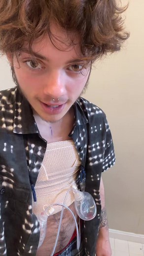 FTM Top Surgery Insights: Personal Journey