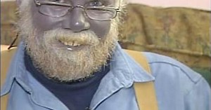 Can Real People Have Blue Skin?