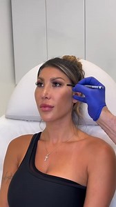 Smooth. Subtle. Effortless. Botox softens forehead lines while keeping natural movement—when done right. The key is precision and proper technique. #BotoxResults #ForeheadBotox #SmoothSkinGoals #EpioneBeverlyHills #SimonOurianMD | Dr. Simon Ourian - Epione
