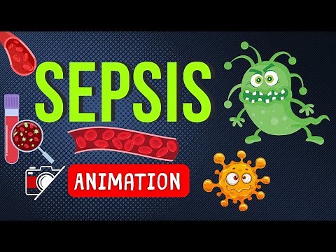 🦠 SEPSIS ANIMATION | 🎬 FUNNY, MEMORABLE, MNEMONIC !