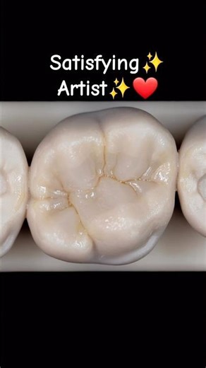 Anatomy for upper molars🦷✨❤#anatomy #اكسبلور #تجميلاسنان #ترند #dentalprosthesis #duet #dentalartist