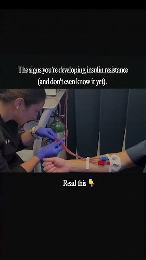 The signs you're developing insulin resistance (and don't even know it yet) 🧬