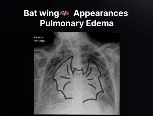 #Cardiology #health#doctor