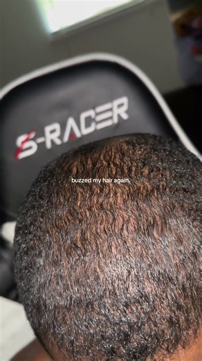 buzz cut | men’s hairloss