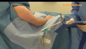 Setting up for Beach Chair Shoulder Procedure