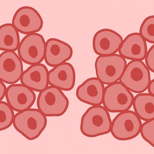 7 talks with insights on breast cancer | TED Talks