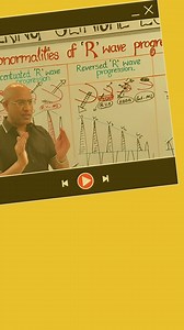 ✨ Eid Jackpot Sale – Offer Ends Soon! ✨ 🎁 Lifetime Access to Dr. Najeeb’s Lectures Notes for Just $12! 🎁 ⏳ Hurry! Limited-Time Offer – Don’t Miss Out! ⏳ 📚 1000 In-Depth Video Lectures Notes covering Basic Medical Sciences & Clinical Medicine 🎨 Crystal-Clear Hand-Drawn Illustrations for Easy Understanding 💡 Trusted by 80% of Medical, Dentistry, Nursing & Pharmacy Scholars in 190 Countries 🏆 Your Ultimate Companion for USMLE Step 1, COMLEX, NBDE, NCLEX & PANCE Exams 🔥 This Exclusive Offer i