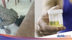 Parah! Ketahuan Pacaran, Remaja Ini Dipaksa Minum Air Kencing dan Liur