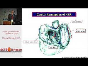 Evolution of Maze procedure