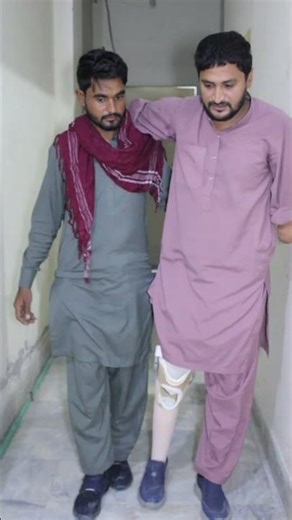 PTB Prosthesis with Thigh Weight Bearing | #LowerLimbProsthesis #prostheticcare