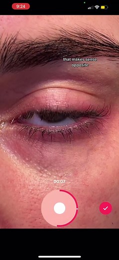 Eye Tutorial: How to Record Your Eye on Phone