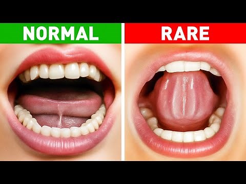 Discover How Rare Your Body Really Is