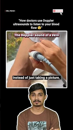 How doctors use Doppler ultrasounds to listen to your blood flow 🤯😲