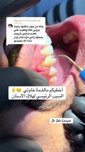 #dentist #dental #tiktokviral