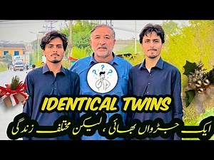 You Won’t Believe 😲 Identical Twins with Totally Different Styles | Shocking Transformation