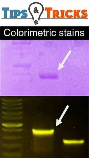 Colorimetric stains vs Fluorescent stains