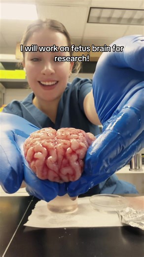 Challenges of Researching Fetal Brain Development