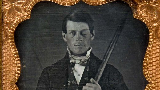 Psicología: 10 clásicos estudios de casos | Psyciencia