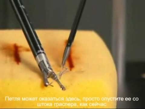 Endo Stitch