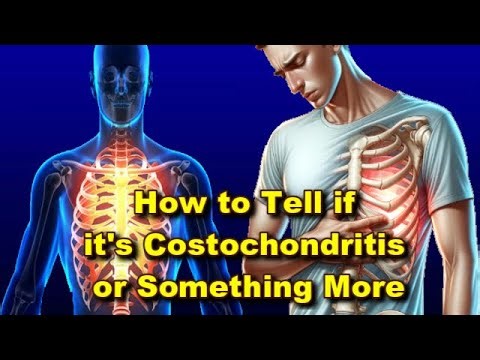 The Non-Cardiac Chest Pain: How To Tell If It's Costochondritis Or Something More