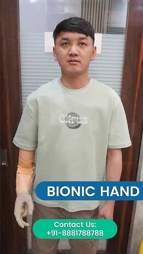 India’s Most Advanced Bionic Hand is Here| Real Tech, Real Lives #Artificial_limb P&O International