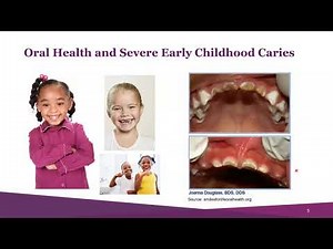 Webinar: Promoting Use of Childhood Dental Benefits Covered Under Medicaid & CHIP (2/18/21)