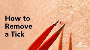 Always use tweezers or a tick spoon to remove a tick. After removing the tick, put the tick in rubbing alcohol to kill it. Do not use petroleum jelly, nail polish, or matches to remove a tick. These methods can increase your risk of getting a localized skin infection. | Maine CDC